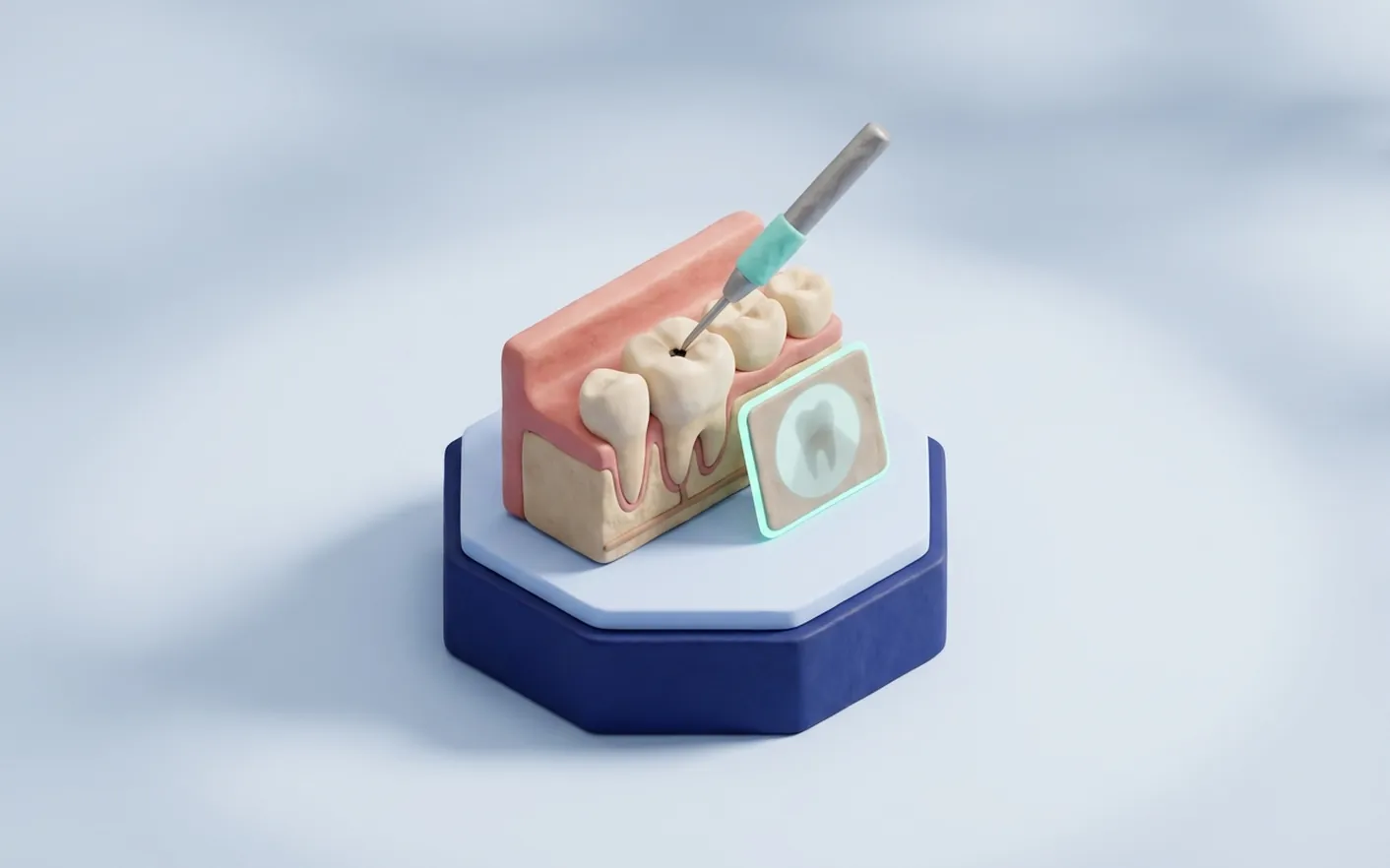 Cosa si fa in studio per i denti sensibili? Foto dello studio di Via Tripoli.