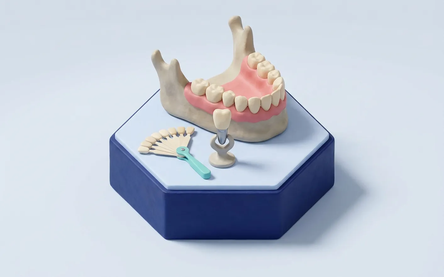 Come si decide la forma dei denti prima di intervenire? Foto dello studio di Via Tripoli.